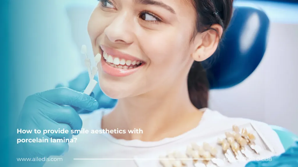 How to provide smile aesthetics with porcelain lamina?
