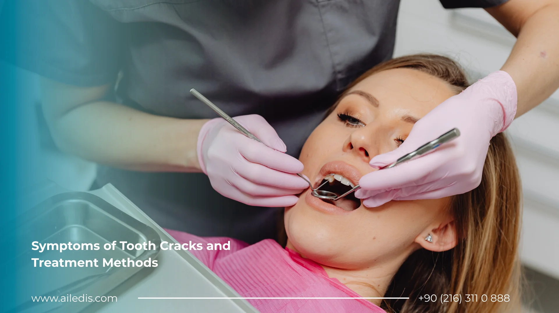 Symptoms of Tooth Cracks and Treatment Methods