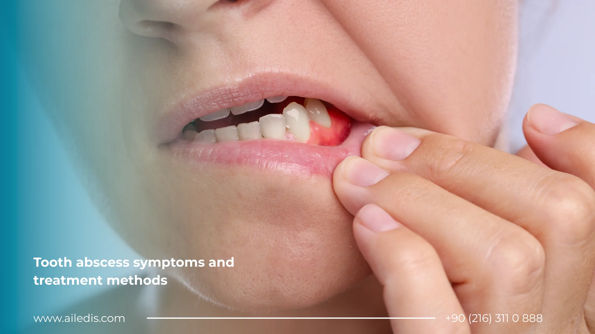 Tooth abscess symptoms and treatment methods