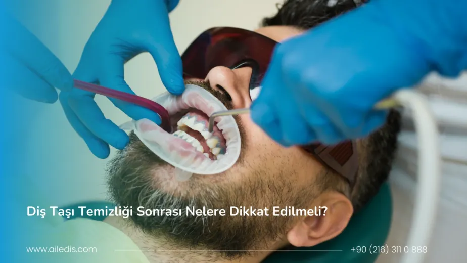 diş taşı temizliği sonrası