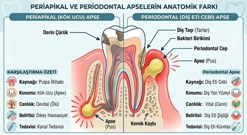 Diş Apsesi Belirtileri ve Tedavi Yöntemleri 1 periapikal ve periodontal apse
