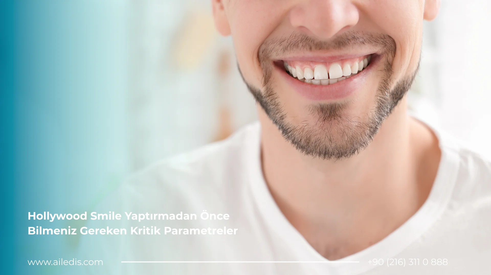 Hollywood Smile Yaptırmadan Önce Bilmeniz Gerekenler