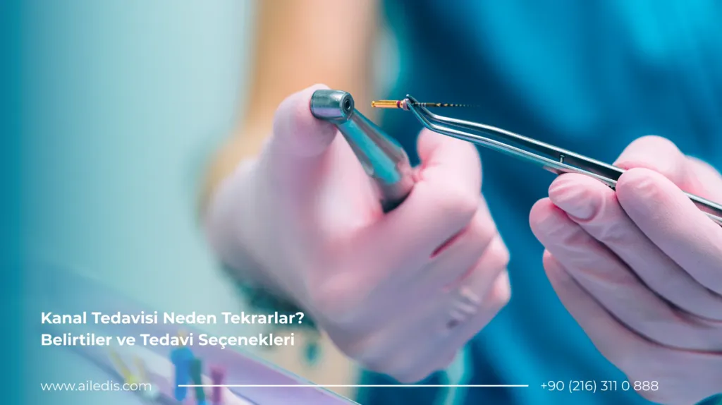 Kanal Tedavisi Neden Tekrarlar