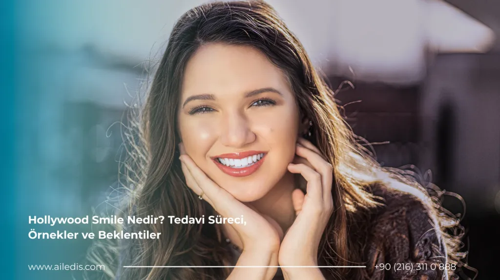 Hollywood Smile Nedir