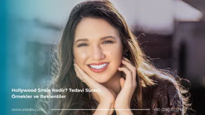 Hollywood Smile Nedir