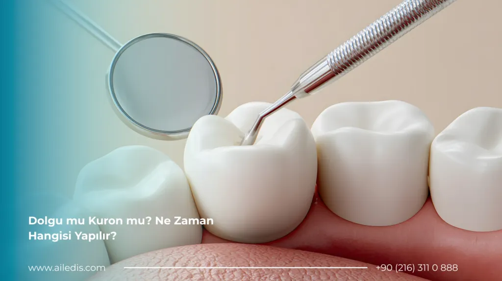 Protetik Diş Tedavisi 2 Dolgu mu Kuron mu? Ne Zaman Hangisi Yapılır?