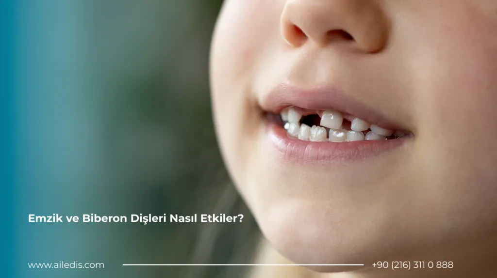 Pedodonti (Çocuk Diş Hekimliği) 2 Emzik ve Biberon Dişleri Nasıl Etkiler