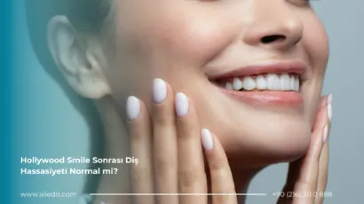 Hollywood Smile Sonrası Diş Hassasiyeti