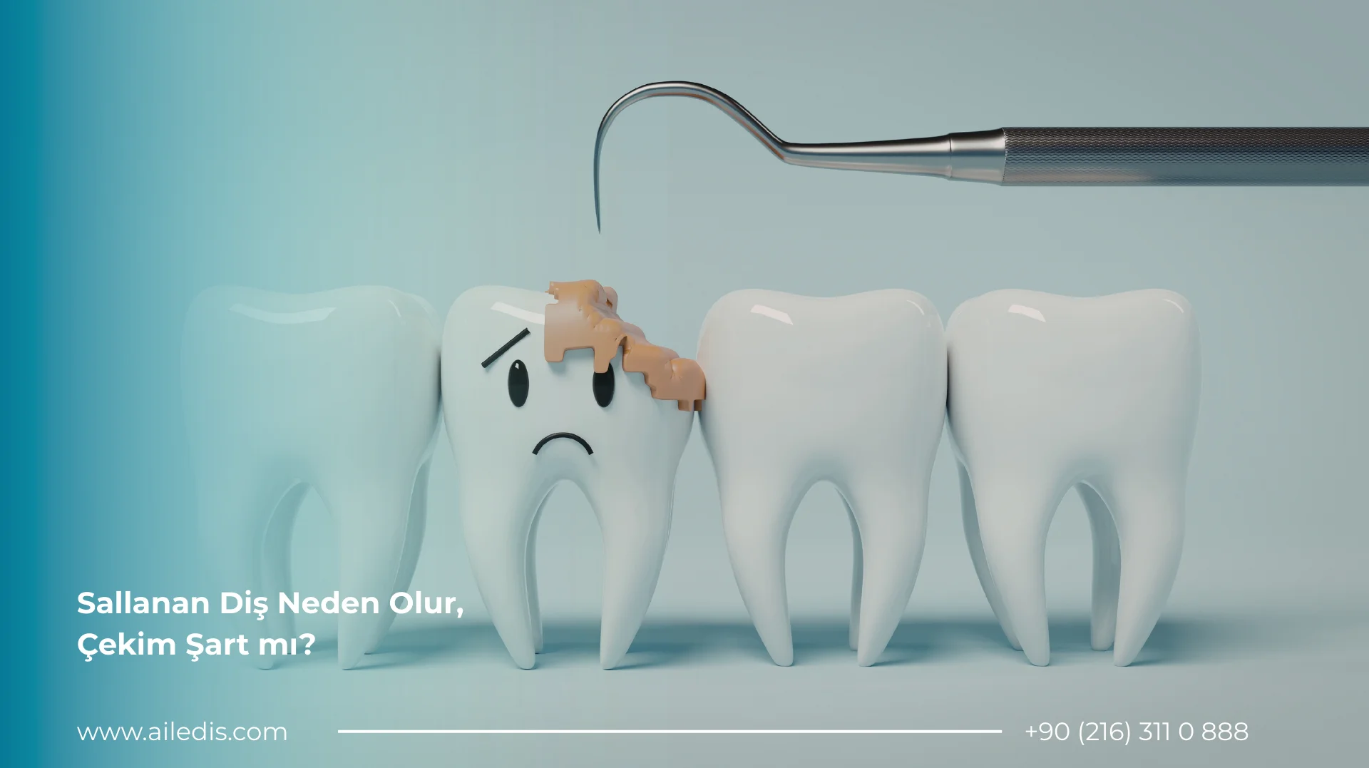 Sallanan Diş Neden Olur, Çekim Şart mı