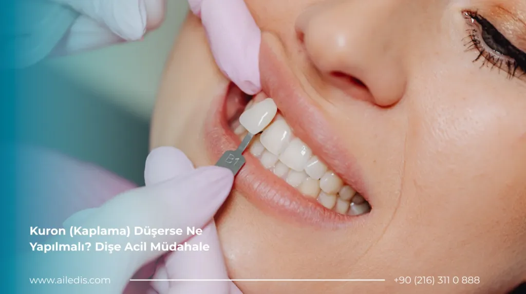 Kuron Kaplama Düşerse Ne Yapılmalı