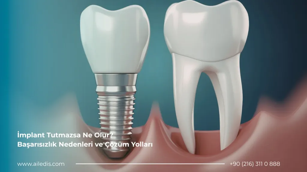 İmplant Tutmazsa Ne Olur Başarısızlık Nedenleri