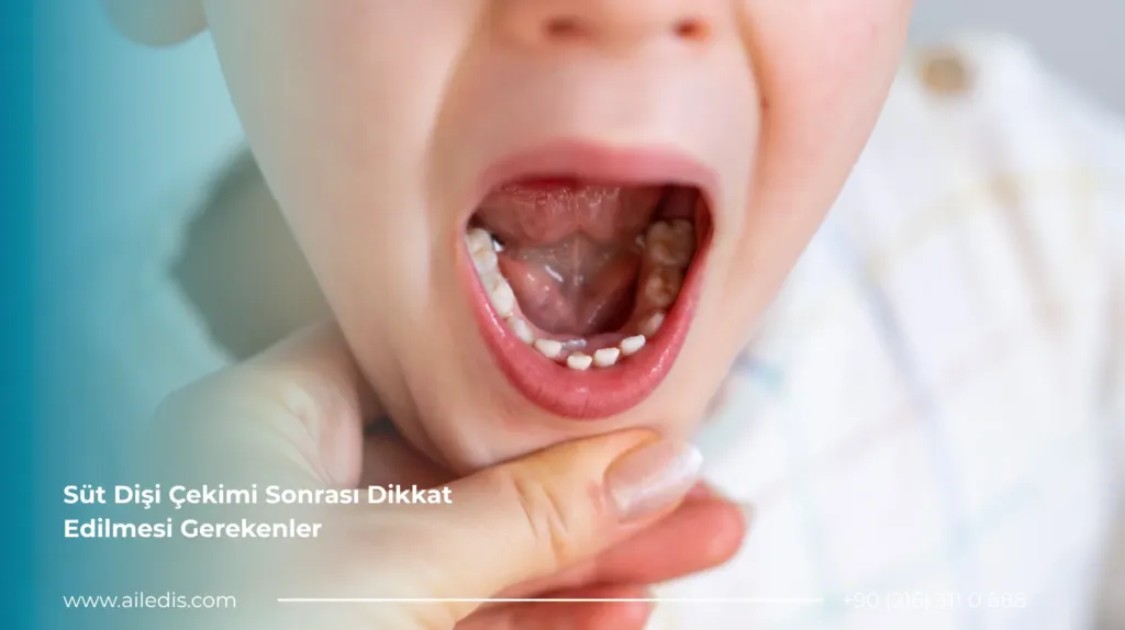 Süt Dişi Çekimi Sonrası