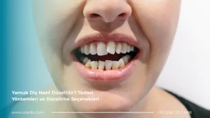 yamuk diş nasıl düzeltilir
