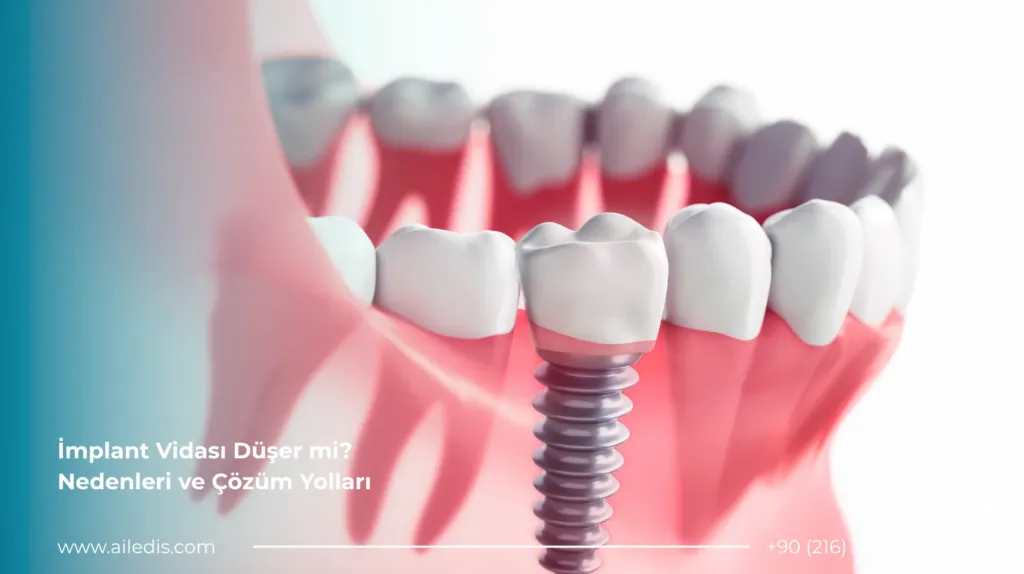implant vidası çıktı