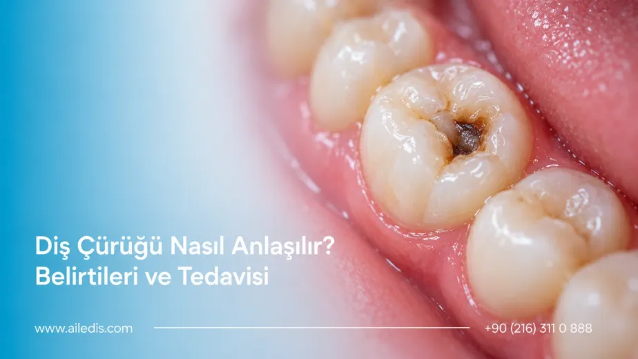 dis curugu nasil anlasilir