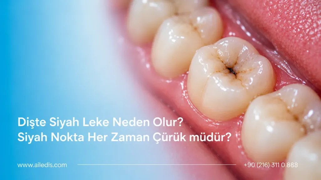 Dişte Siyah Leke